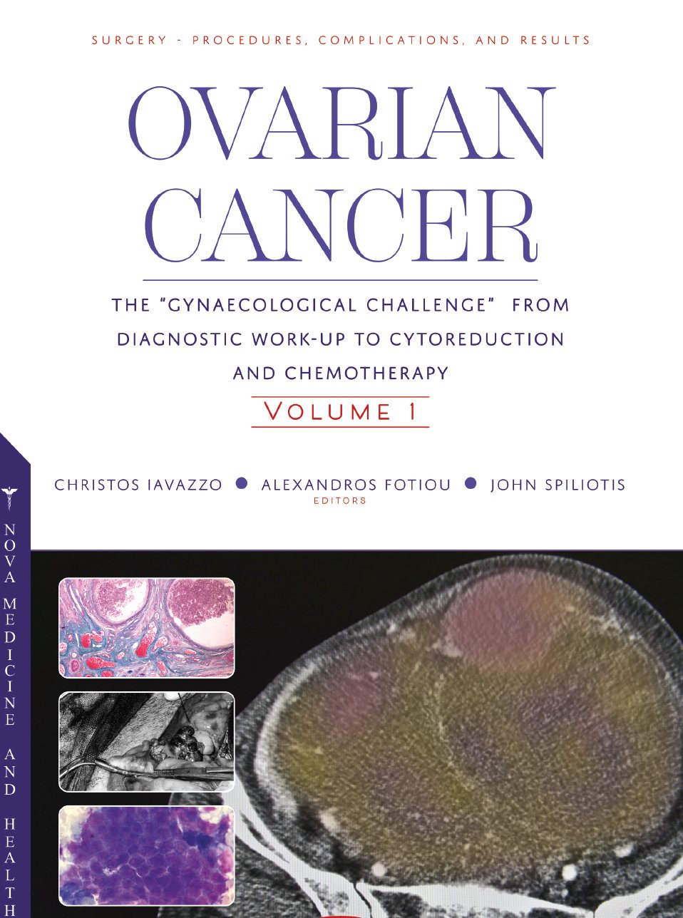Ovarian Cancer Volume 1 kitabının kapağı